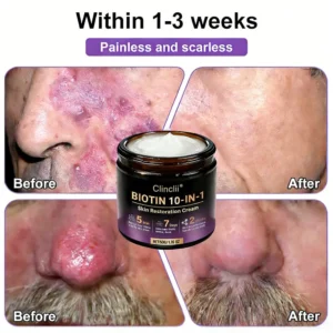 Made and Shipped from Biotin 10-in-1 Skin Restoration Cream - Last Day Promotion: 75% OFF - Image 6