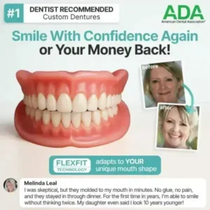 Custom-Fit Full Functional Dentures