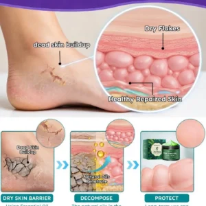 🎁 Limited-Time Offer 🎁 - Don't miss out!Tea Tree Oil Foot Cream (Repairs Dry Cracked Heels, Soothes Tired Feet, Eliminates Odor & Restores Soft Skin) - Image 9