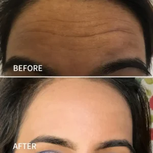 Anti-Wrinkle Face Tape for Frown Lines, Crow’s Feet & Smile Lines, 110 Pre-Cut Strips - Image 6