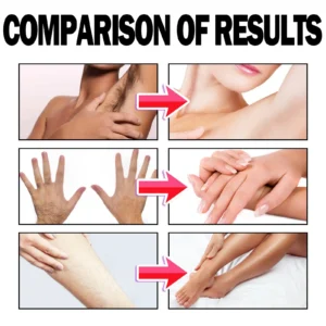 Hair Removal Mousse for Mrs - Image 10