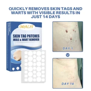Moles & Warts Removing Skin Tag Patch - Image 3
