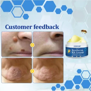 BeeDerm RX Cream - Image 19