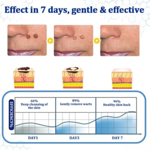 BeeDerm RX Cream - Image 9