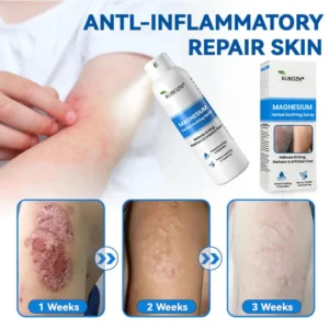 🇭✅ Official Magnesium Herbal Spray – Fast Relief for Psoriasis & Eczema | No-Rub, Steroid-Free - Image 2