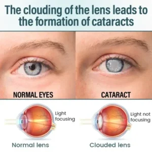 OptiFusion Nano Eye Drops Serum - Image 6
