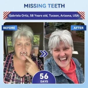🦷 Tideglusib Fast‑Dissolving Tooth & Gum Repair Oral Strips 😁 (Supports tooth repair and helps relieve gum discomfort and other common oral concerns)
