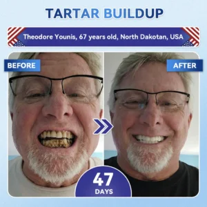 🦷 Tideglusib Fast‑Dissolving Tooth & Gum Repair Oral Strips 😁 (Supports tooth repair and helps relieve gum discomfort and other common oral concerns) - Image 4