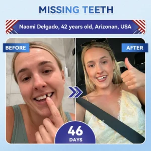 🦷 Tideglusib Fast‑Dissolving Tooth & Gum Repair Oral Strips 😁 (Supports tooth repair and helps relieve gum discomfort and other common oral concerns) - Image 9