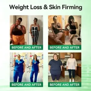 10-in-1 Micro-Patch Tech Weight Management Skin Support Visible Results - Image 3