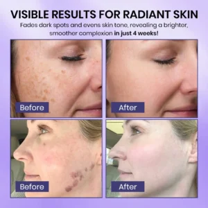 Radiglow Brightening Dark Spot Cream - Image 6