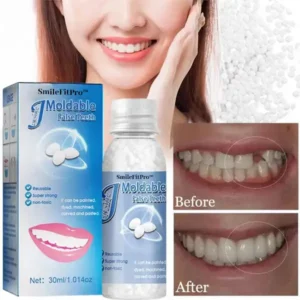 🦷 Dental Filling Gel – Pain-Free, Drill-Free Cavity Solution💖💖 - Image 2