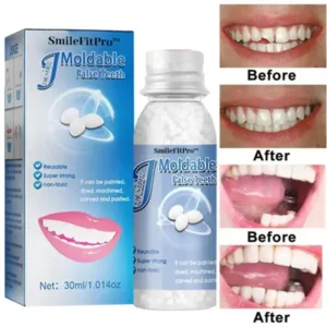 🦷 Dental Filling Gel – Pain-Free, Drill-Free Cavity Solution💖💖 - Image 3