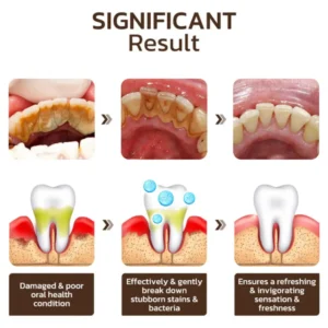 Niacinamide Whitening Toothpaste - Image 15