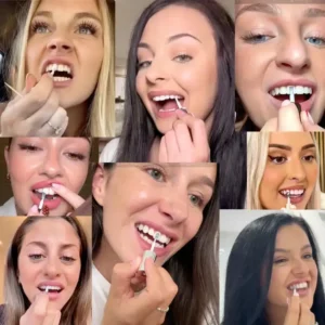 Tooth Whitening Instant Clean Smile - Image 5