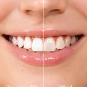 Tooth Whitening Instant Clean Smile - Image 7