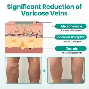 LegRenew Varicose Veins Patch - Image 5