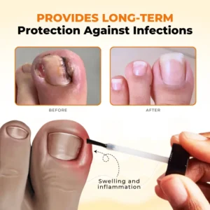 NailRevive Bee Venom Anti-fungi Solution - Image 8
