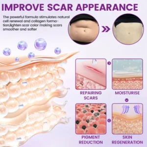 ScarVanisher Scar Gel - Image 7