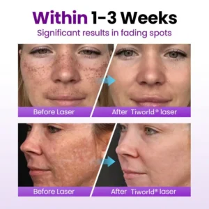 SpotErase Probiotic Shield Serum - Image 11