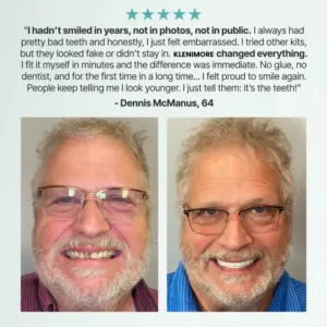 🔥Up to 70% off today Full Denture with Strong Suctiond🦷 - Image 8