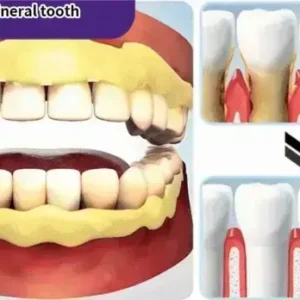 Teeth Restoration Mineral Powder - Image 17