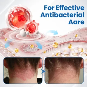 Fragile Skin Repair Cream - Image 10