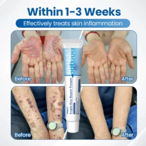 Fragile Skin Repair Cream - Image 2