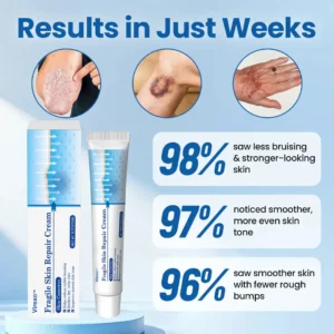 Fragile Skin Repair Cream - Image 4