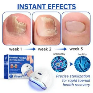 PureNail Fungus Laser Device - Image 8