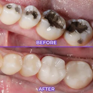 SensiGum Fluoride Toothpaste - Image 4
