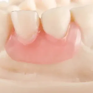 Premium Denture - Image 6
