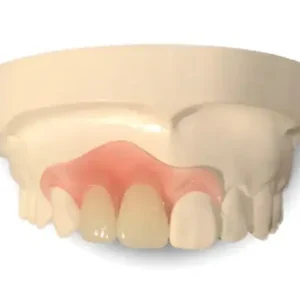 Premium Denture - Image 7