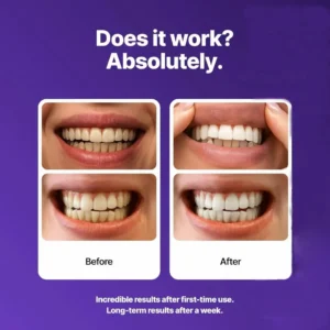 Whitening Strips - Image 7