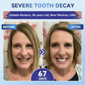 Your Smile~ 🦷 Tideglusib Fast‑Dissolving Tooth & Gum Repair Oral Strips ✨ (𝟓-𝐢𝐧-𝟏 💎 𝐑𝐞𝐛𝐮𝐢𝐥𝐝 𝐄𝐧𝐚𝐦𝐞𝐥 & 𝐃𝐞𝐧𝐭𝐢𝐧 • 𝐒𝐭𝐫𝐞𝐧𝐠𝐭𝐡𝐞𝐧 𝐆𝐮𝐦𝐬 • 𝐄𝐫𝐚𝐝𝐢𝐜𝐚𝐭𝐞 𝐓𝐚𝐫𝐭𝐚𝐫 & 𝐎𝐝𝐨𝐫 • 𝐖𝐡𝐢𝐭𝐞𝐧𝐢𝐧𝐠 • 𝐒𝐭𝐨𝐩 𝐓𝐨𝐨𝐭𝐡 𝐒𝐞𝐧𝐬𝐢𝐭𝐢𝐯𝐢𝐭𝐲) - Image 3
