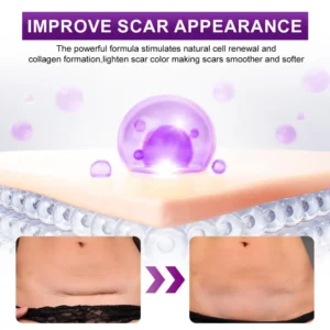cure FACE & BODY SCAR GEL - Image 3