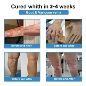 microneedle joint patch - Image 9