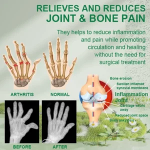 Bee Venom Joint & Bone Therapy Cream - Image 3