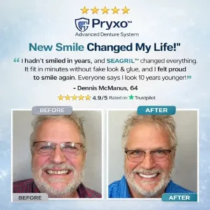 70% off! Complete Dentures