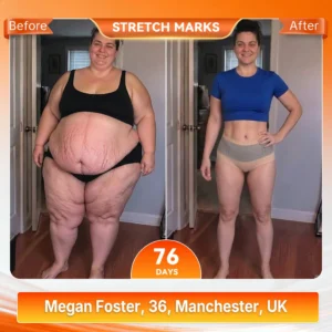Moringa & Berberine 4-in-1 Advanced Sculpting & Fat-Burn Short - Image 2