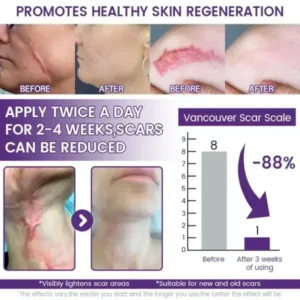 ReGenScar Stem Cell Scar Gel - Image 3