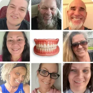 -Ends Today: 70% Custom-Fit Full Functional Dentures Make you more confident - Image 4