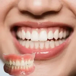 🔥🔥🔥Ends Today: 70% Custom-Fit Full Functional Dentures Make you more confident - Image 2