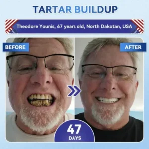 Tooth & Gum Repair - Image 3