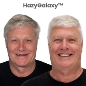 ··🦷 Custom-Fit Dentures ⏰ ENDS TODAY 70% OFF | Smile with Confidence - Image 7