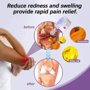Turmeric & Emu Oil Arthritis Soothing Pain Relief Massage Gel - Image 5