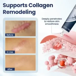 DERMALUX Texture Repair Gel - Image 4