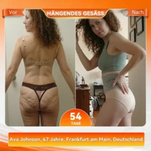 2026: Intelligente Moringa & Berberin Shaping-Shorts für effektive Fettverbrennung - Image 4
