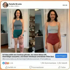 2026 NEUERSCHEINUNG 𝐌𝐨𝐫𝐢𝐧𝐠𝐚 & 𝐁𝐞𝐫𝐛𝐞𝐫𝐢𝐧 4-In-1 Mikropartikel-Formungs- & Fettverbrennungs-Shorts - Image 5