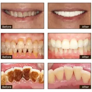 Niacinamide Whitening Toothpaste - Image 3